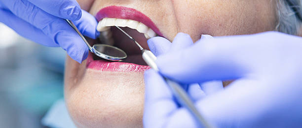 Emergency Cosmetic Dentistry (e.g., broken veneers)